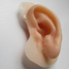 Prótesis de Pabellón Auricular Personalizadas: Naturalidad, Estética y Confianza