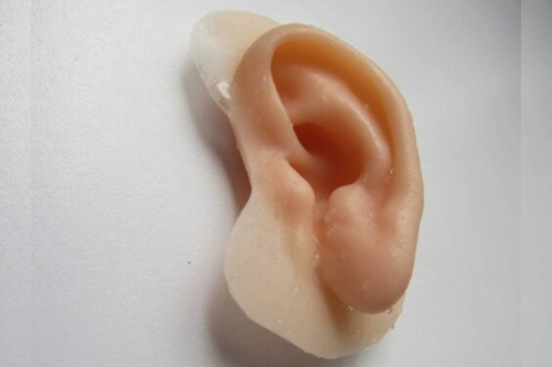 Prótesis de Pabellón Auricular Personalizadas: Naturalidad, Estética y Confianza