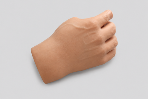 Prótesis de Mano Completa: Innovación para una Mejor Calidad de Vida