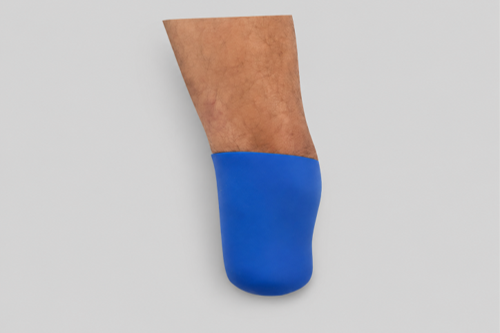 Endosocket en Silicona: Comodidad, Protección y Ajuste Personalizado