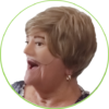 facial 2 Prótesis Faciales Personalizadas: Recupera tu Imagen y Confianza