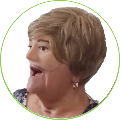 facial 2 Prótesis Faciales Personalizadas: Recupera tu Imagen y Confianza