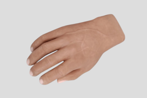 Prótesis de Mano Completa: Innovación para una Mejor Calidad de Vida