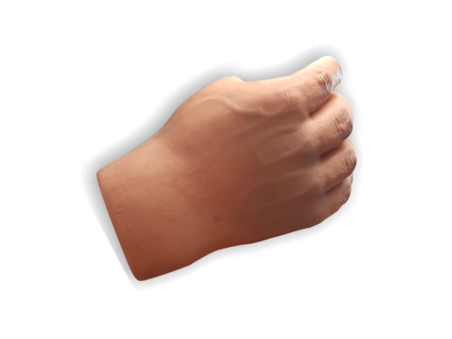 Prótesis de Mano Completa: Innovación para una Mejor Calidad de Vida