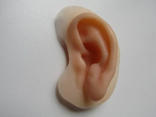 Prótesis de Pabellón Auricular Personalizadas: Naturalidad, Estética y Confianza