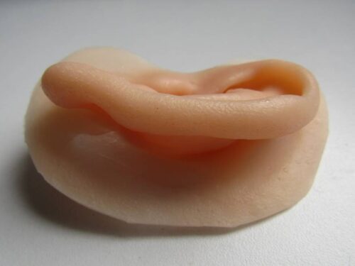 Prótesis de Pabellón Auricular Personalizadas: Naturalidad, Estética y Confianza
