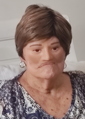 rostroJerAnaplastologia Prótesis Faciales Personalizadas: Recupera tu Imagen y Confianza