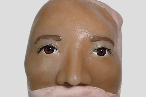 Prótesis Faciales Personalizadas: Recupera tu Imagen y Confianza