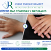 Prótesis de Dedo: Recupera la Funcionalidad y la Estética